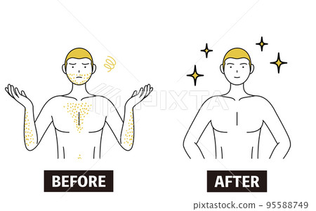 Image of medical hair removal, before and after a man who is worried about having thick body hair loses his hair and becomes full of confidence Image of medical hair removal, before and after a man who is worried about having thick body hair loses his hair and becomes full of confidence 95588749