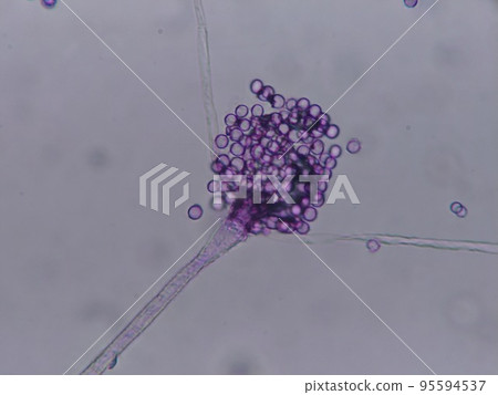 Aspergillus aspergillus micrograph up 95594537