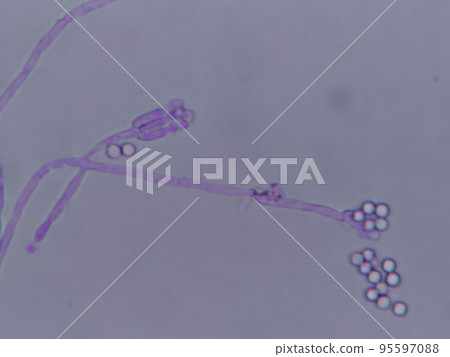 conidia of the genus Penicillium conidia of the genus Penicillium 95597088