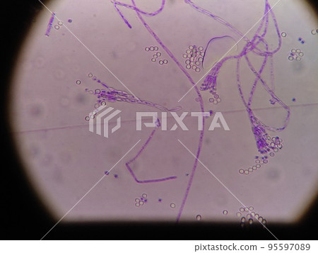 Micrograph of mold on white mold cheese 95597089