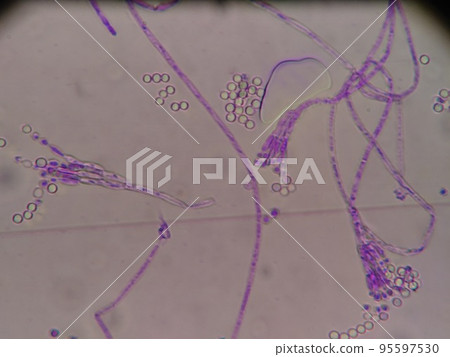 Microscopic photo of mold on moldy cheese Microscopic photo of mold on moldy cheese 95597530