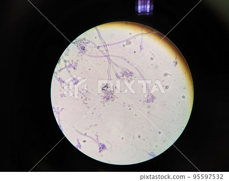 Micrograph of Penicillium mold Micrograph of Penicillium mold 95597532
