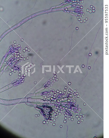Photo of mold that looks like a brush tip Photo of mold that looks like a brush tip 95597533