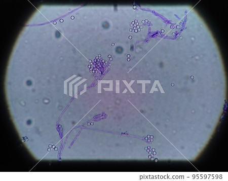 子囊菌骨架 子囊菌骨架 95597598