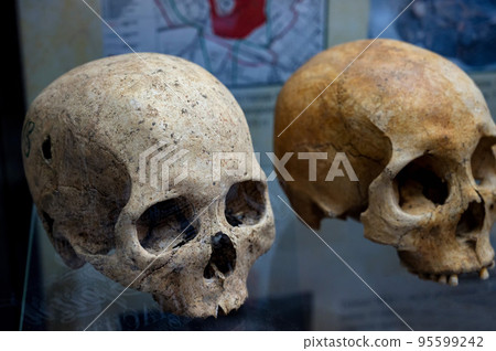An exhibit of a human skull. Real human skull. 95599242