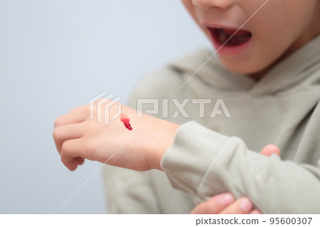 流鼻血的小學生(帶血的圖片) 流鼻血的小學生(帶血的圖片) 95600307