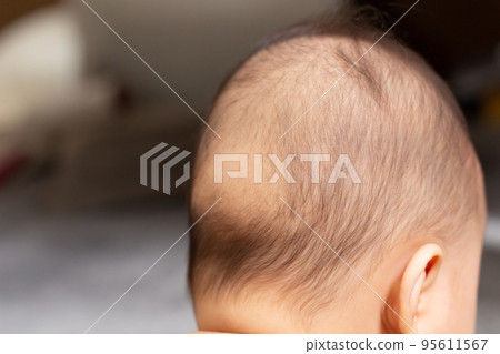 Baby with bald back (sleeping bald) Baby with bald back (sleeping bald) 95611567