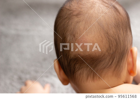 Baby with bald back (sleeping bald) Baby with bald back (sleeping bald) 95611568
