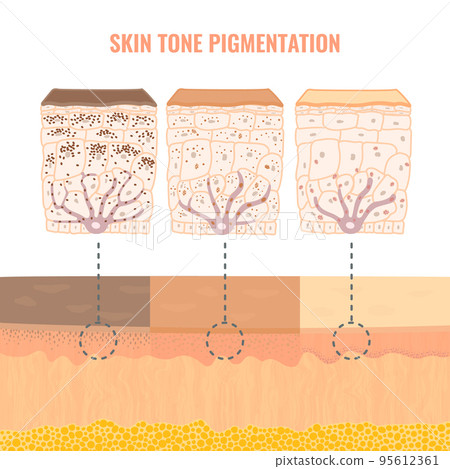 Human skin tone pigmentation diversity infographic diagram 95612361