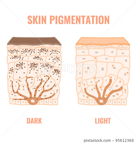 Human skin tone pigmentation diversity infographic diagram Human skin tone pigmentation diversity infographic diagram 95612368