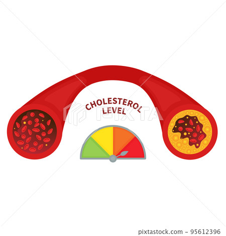 Cholesterol level meter gauge with blood vessel 95612396