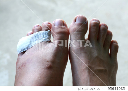 when the foot have accident when the foot have accident 95651085
