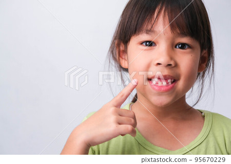Portrait of an Asian girl with broken upper baby teeth and first permanent teeth. Friendly little girl showing her broken teeth isolated on white background. 95670229