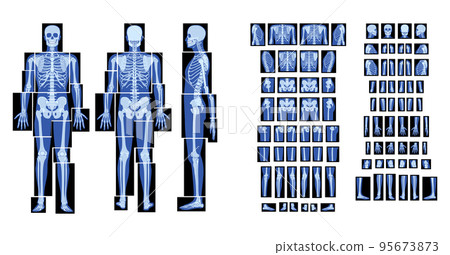 Set of X-Ray Skeleton Human body - hands, legs, chests, heads, vertebra, pelvis, Bones adult people roentgen front back Set of X-Ray Skeleton Human body - hands, legs, chests, heads, vertebra, pelvis, Bones adult people roentgen front back 95673873