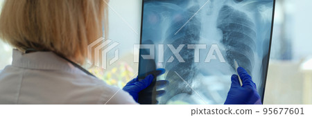 Doctor diagnoses health status of patient with asthma, lung diseases and COVID-19 Doctor diagnoses health status of patient with asthma, lung diseases and COVID-19 95677601