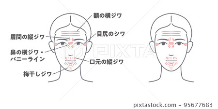 老化跡像圖-2-皺紋 老化跡像圖-2-皺紋 95677683