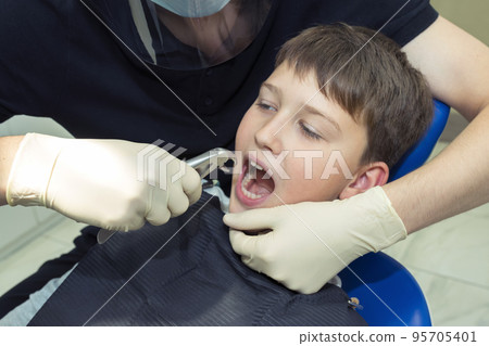 A close-up of a boy in a dental clinic. A doctor doing a procedure of pulling out a tooth with dental forceps A close-up of a boy in a dental clinic. A doctor doing a procedure of pulling out a tooth with dental forceps 95705401