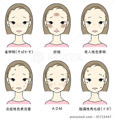 適合患有瑕疵和雀斑的女性的套裝 帶有字母的瑕疵類型 95718447