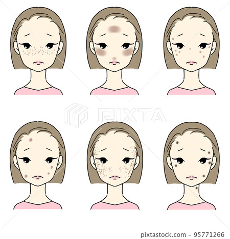 A set for women who suffer from blemishes and freckles Types of blemishes No letters A set for women who suffer from blemishes and freckles Types of blemishes No letters 95771266