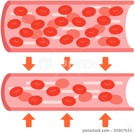 Blood vessels (hypertension) 95807033