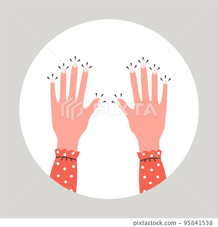 Tingling and numbness in the hands. Finger sensitivity problem. Flat vector illustration Tingling and numbness in the hands. Finger sensitivity problem. Flat vector illustration 95841538