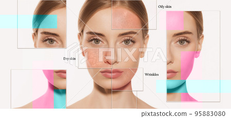 Collage. Female skin problems close-up. Beautiful brunette woman and facial diseases: acne, blackheads, dry, oily, wrinkles. Skincare, healthcare, beauty, health, aging process 95883080