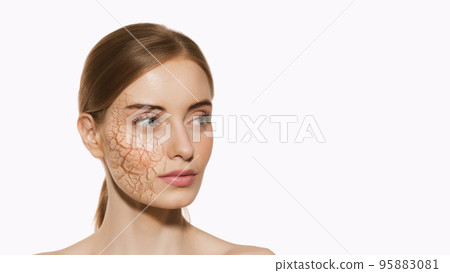 Beautiful girl with dry facial skin before moistening isolated on white background. Skincare, healthcare, beauty, aging process, wrinkles, dehydration and skin problems 95883081