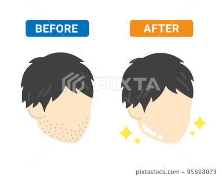 一個男人刮鬍子前後的插圖 一個男人刮鬍子前後的插圖 95898073