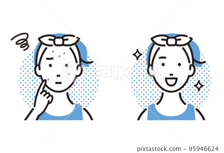 改善粉刺和皮膚粗糙的女孩 95946624