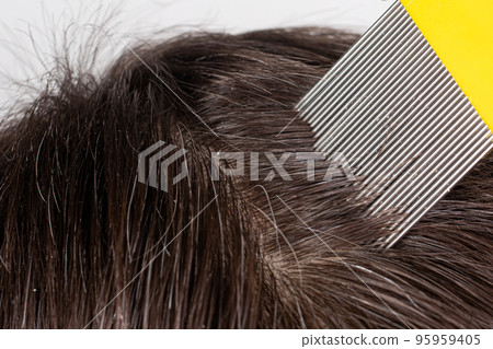 A brunette woman with pediculosis cleans her hair from lice and nits with a comb with small prongs. A lice comb. 95959405