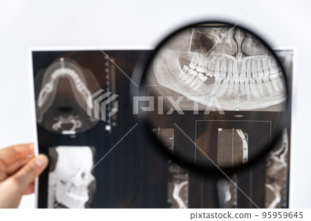 The doctor holds a CT scan of a patient with temporomandibular joint dysfunction and malocclusion. 95959645