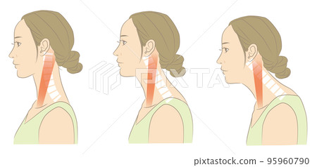 頸椎正常，脖子直的女人 95960790