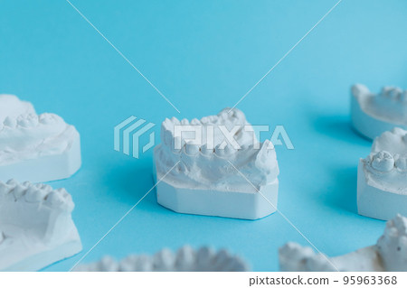 Gypsum model of teeth. Stomatologic plaster cast molds of human jaws on blue background. Dentistry and orthodontics concept 95963368