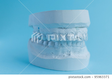 Gypsum mould of human jaw with transparent aligner, invisible retainer or orthodontic silicone trainer on blue background 95963371