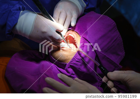 doctor cleaning the teeth patient with ultrasonic tool. Removal of tartar and plaque, prevention of dental disease paradontitis. doctor cleaning the teeth patient with ultrasonic tool. Removal of tartar and plaque, prevention of dental disease paradontitis. 95981199