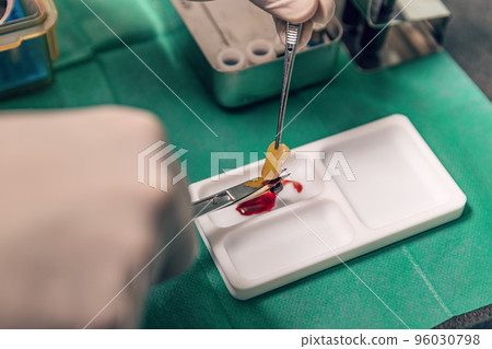 PRF platelet rich fibrin therapy PRF platelet rich fibrin therapy 96030798