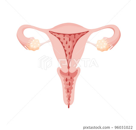 Menstruation in woman, illustration of uterus with blood drops for gynecology, woman health concept. Vector flat icon, female internal organs anatomy. 96031022
