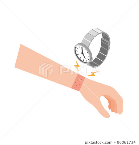 Rough skin due to metal allergy 96061734