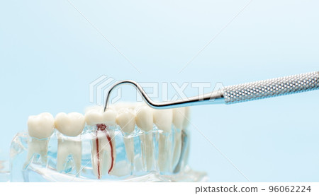 Dentist dental prosthetic teeth, gums, roots close-up. Studying dental diseases concept 96062224