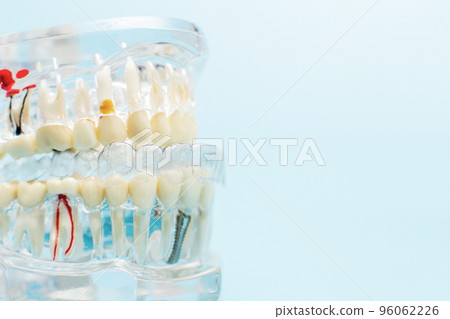 Dentist dental prosthetic teeth, gums, roots close-up. Studying dental diseases concept 96062226