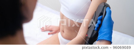 Beautician removing unwanted hair from client arm with laser closeup 96069089