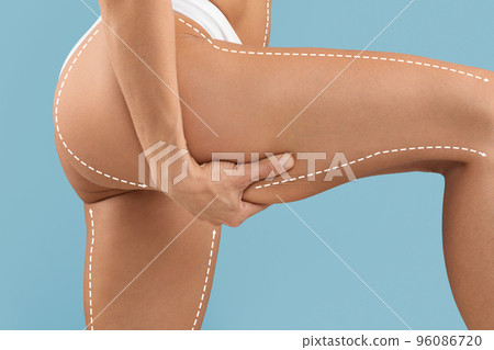 Anti-Cellulite Treatment. Lifting Up Lines Drawn On Perfect Female Body In  Underwear Stock Photo