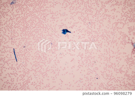 Tissue of Blood human, Vein human, Artery human and Heart muscle human under the microscope in Lab. Tissue of Blood human, Vein human, Artery human and Heart muscle human under the microscope in Lab. 96098279