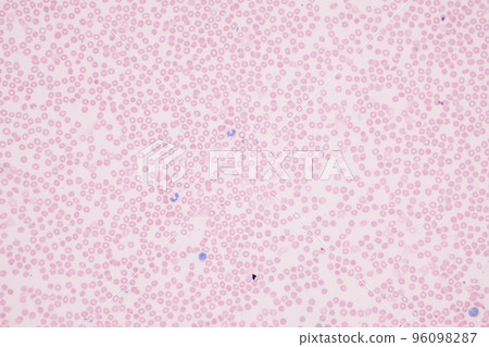 Tissue of Blood human, Vein human, Artery human and Heart muscle human under the microscope in Lab. Tissue of Blood human, Vein human, Artery human and Heart muscle human under the microscope in Lab. 96098287