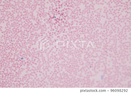 Tissue of Blood human, Vein human, Artery human and Heart muscle human under the microscope in Lab. Tissue of Blood human, Vein human, Artery human and Heart muscle human under the microscope in Lab. 96098292