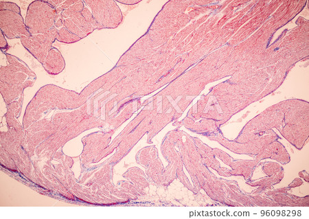 Tissue of Blood human, Vein human, Artery human and Heart muscle human under the microscope in Lab. 96098298