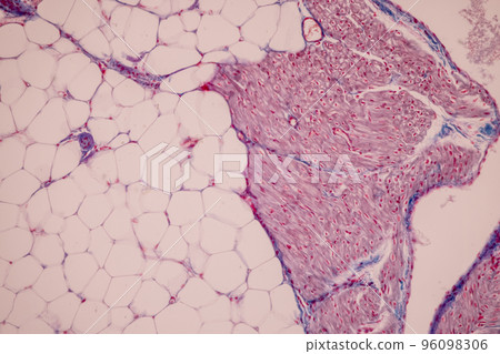 Tissue of Blood human, Vein human, Artery human and Heart muscle human under the microscope in Lab. Tissue of Blood human, Vein human, Artery human and Heart muscle human under the microscope in Lab. 96098306