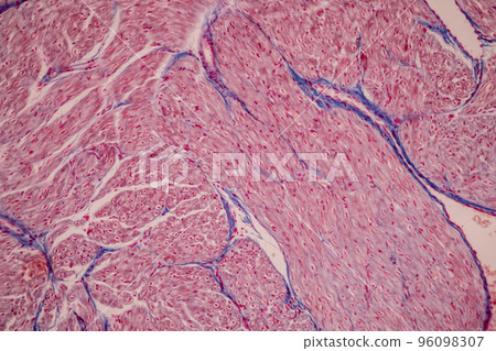 Tissue of Blood human, Vein human, Artery human and Heart muscle human under the microscope in Lab. Tissue of Blood human, Vein human, Artery human and Heart muscle human under the microscope in Lab. 96098307
