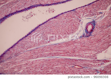 Tissue of Blood human, Vein human, Artery human and Heart muscle human under the microscope in Lab. Tissue of Blood human, Vein human, Artery human and Heart muscle human under the microscope in Lab. 96098308