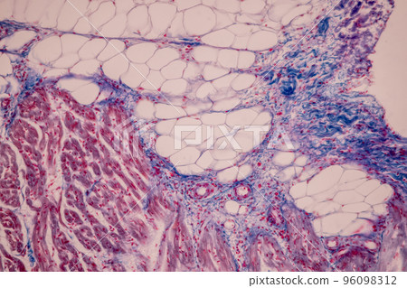 Tissue of Blood human, Vein human, Artery human and Heart muscle human under the microscope in Lab. Tissue of Blood human, Vein human, Artery human and Heart muscle human under the microscope in Lab. 96098312